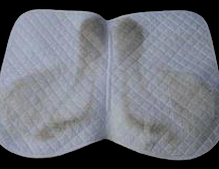 Saddle Pad Dust Patterns & Saddle Fit